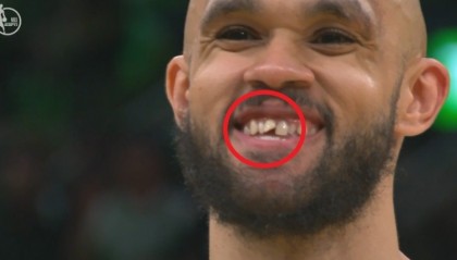 小白谈去年总决赛被打门牙：之后我进了三分 是我最美好回忆之一